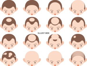 agaイラスト-300x228