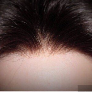 iOS-の画像-16-300x300