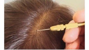 iOS-の画像-18-300x169